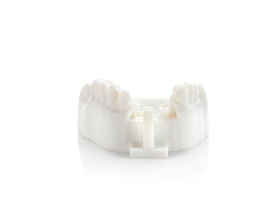 3D Printed Dentures using Statasys VeroDent DEN847 PureWhite