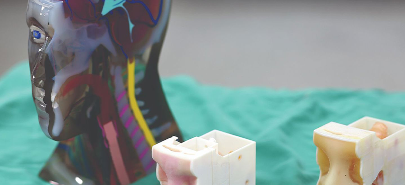 Centre for Biomedical and Technology Integration utilizes 3D printing for surgical planning.